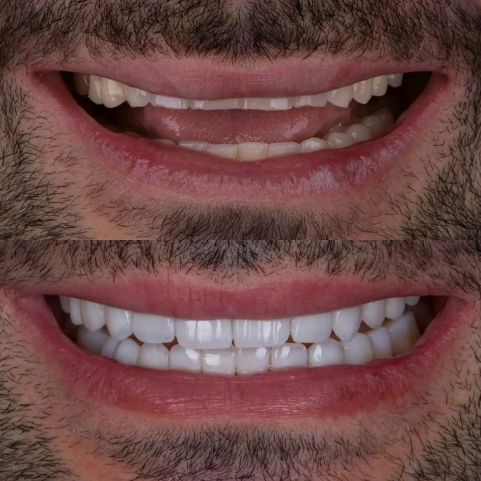 Antes y después caso clínico 10