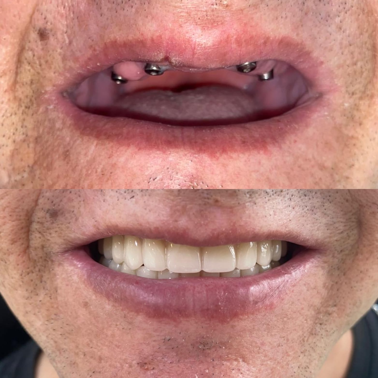 Antes y después caso clínico 12