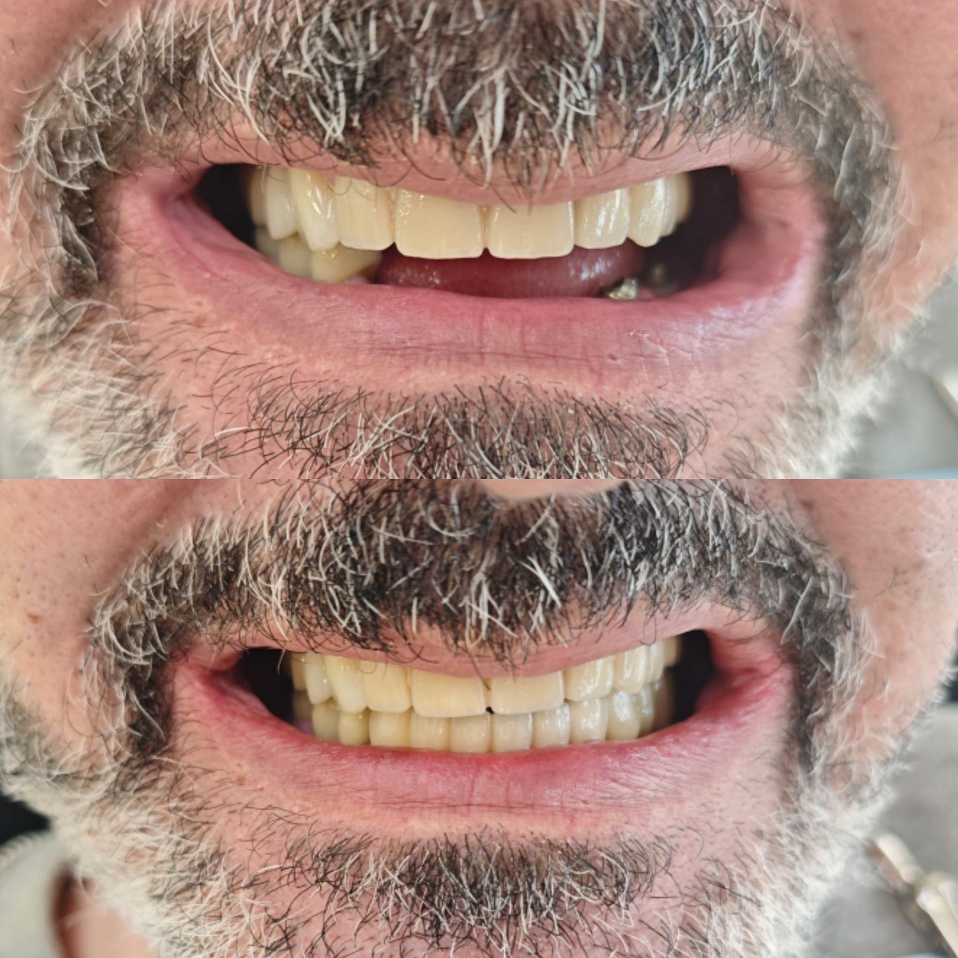 Antes y después caso clínico 15