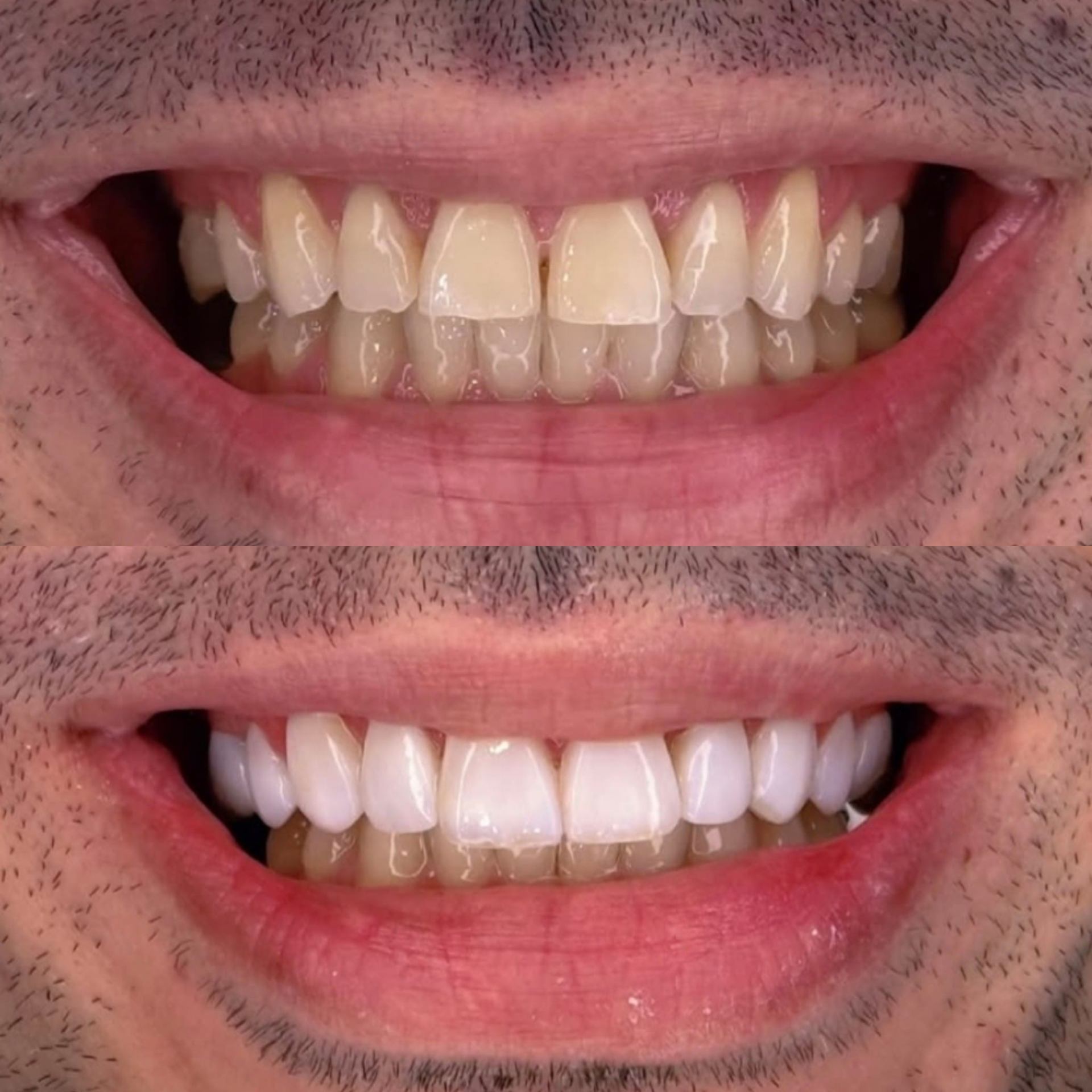 Antes y después caso clínico 27