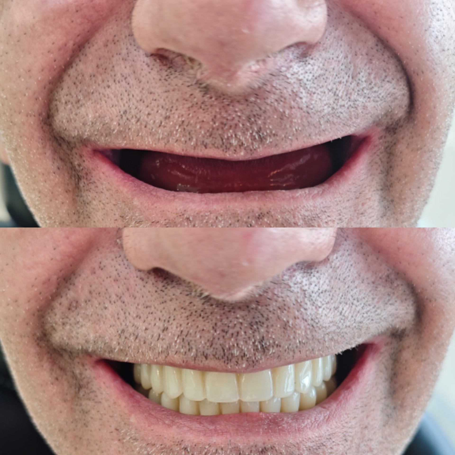 Antes y después caso clínico 8